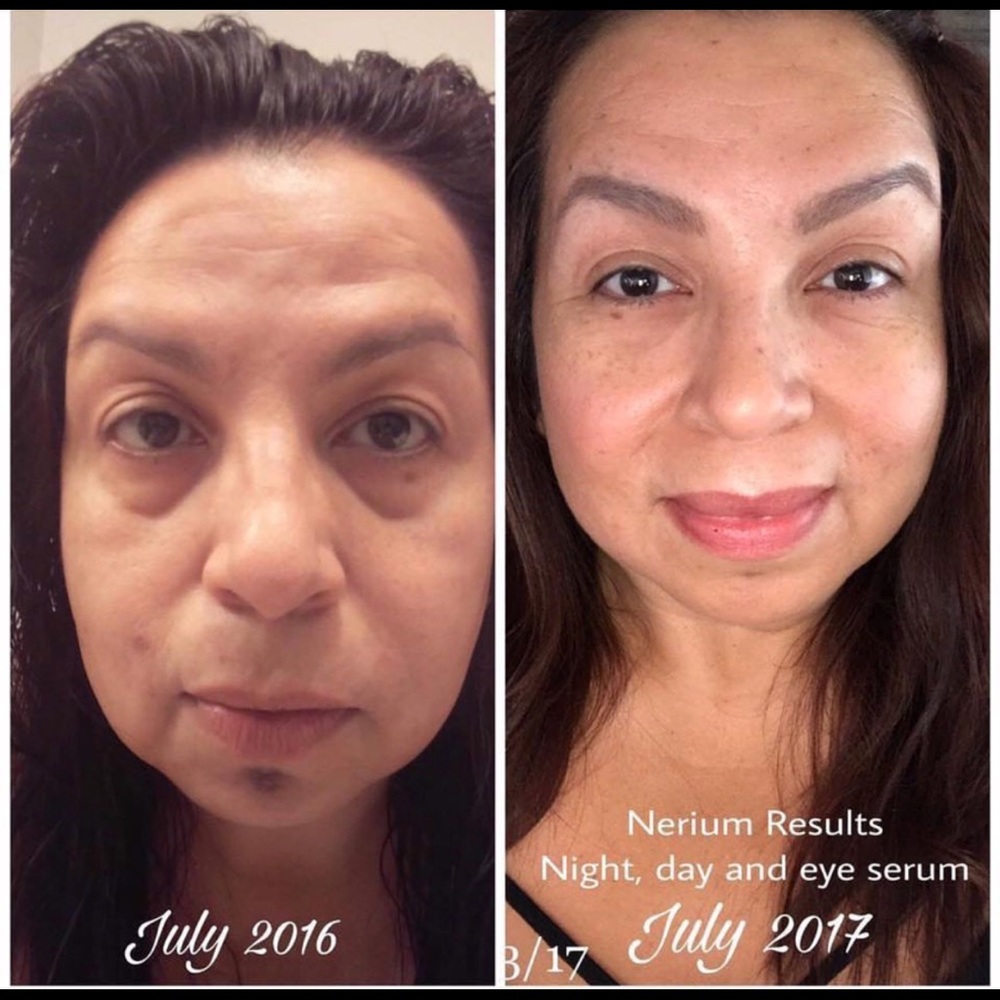 Holistic skincare product. Wrinkle free skin.